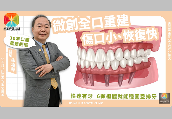 【微創全口重建】新華牙醫 #朱裕華 醫師改善你多顆缺牙問題 Lucky 7