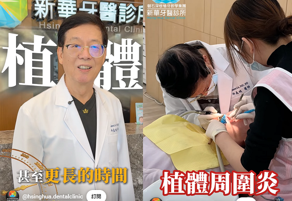 植牙可以用一輩子嗎？答案在這裡