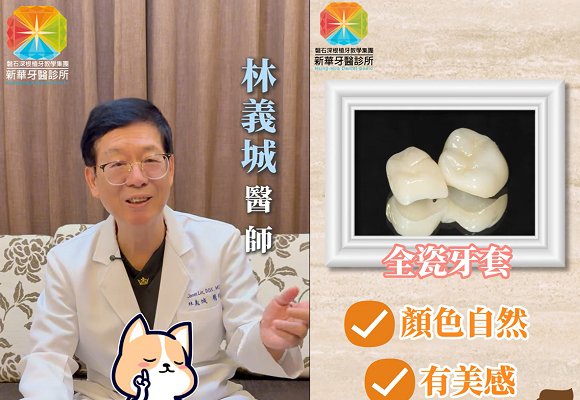 假牙不再是金光閃閃！林義城院長帶你認識更適合你的牙套