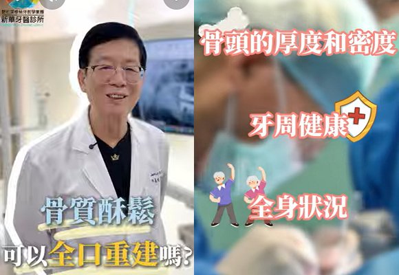 【有骨質疏鬆,還能植牙或全口重建嗎】