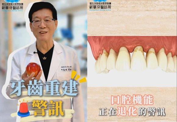 天吶！連蘋果都咬不動…我的牙齒到底怎麼了？